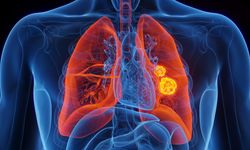 Süper aşı, kanserin yayılmasını tamamen durdurabilir