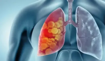 Elektronik sigara tehlikesi