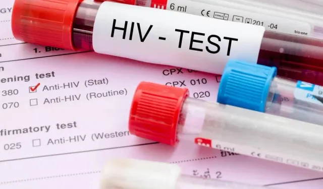 Tabipleri Birliği: HIV şüphesi veya tanısı olan her bireyin sağlık sistemine güvenle erişim hakkı sağlanmalı